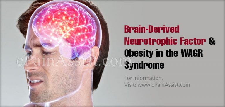 Brain-Derived Neurotrophic Factor and Obesity in the WAGR Syndrome