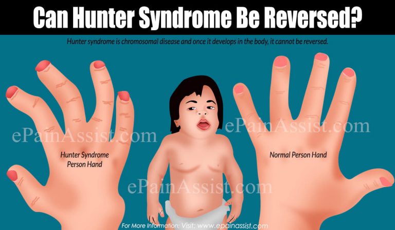 Can Hunter Syndrome Be Reversed & What Is Its Treatment?