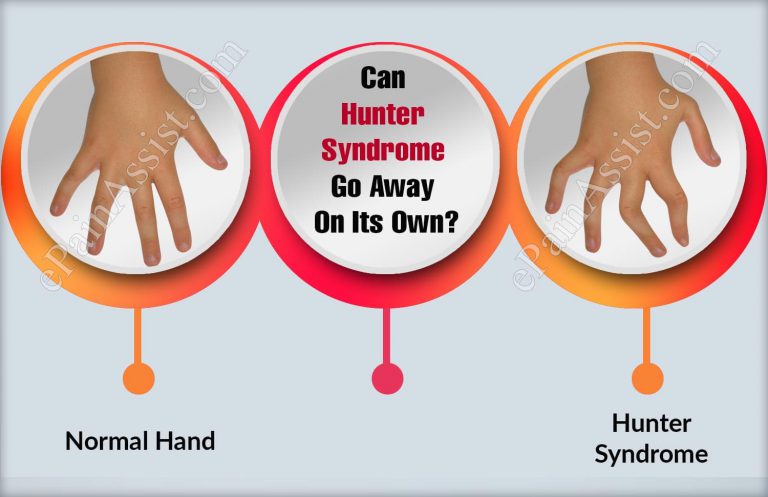 Can Hunter Syndrome Go Away On Its Own?
