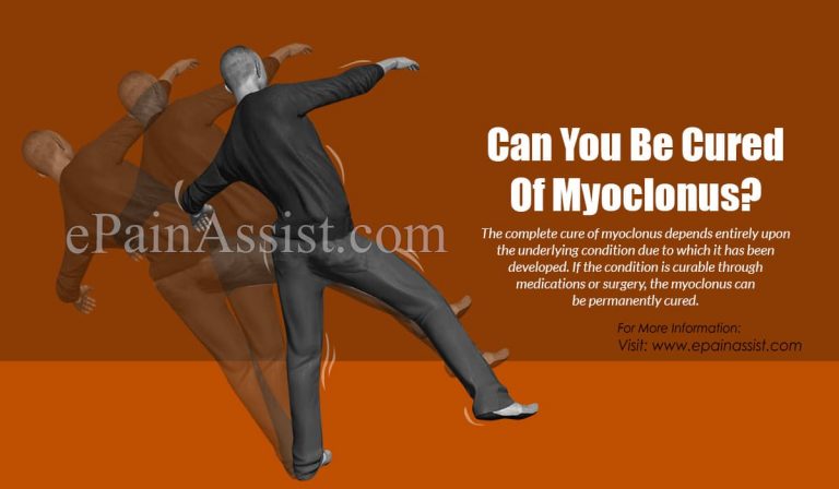 Can You Be Cured Of Myoclonus?