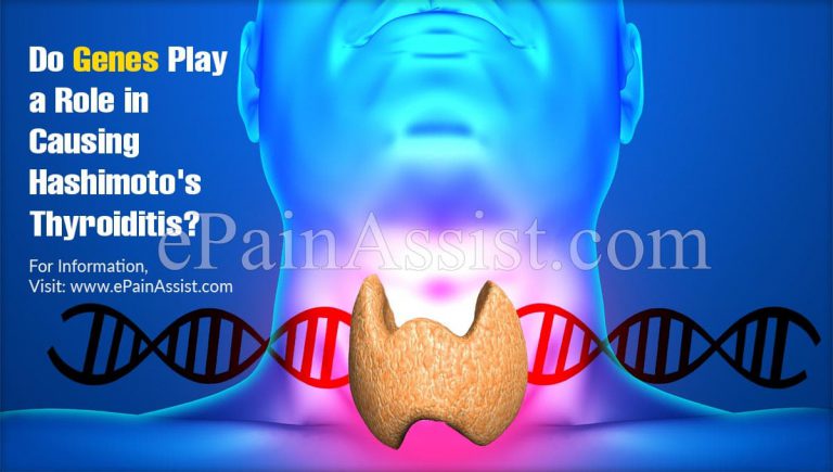 Do Genes Play a Role in Causing Hashimoto’s Thyroiditis?