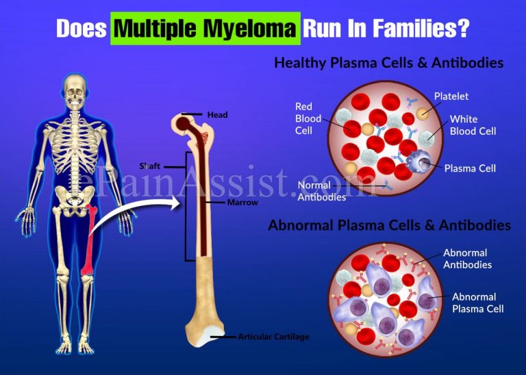 Does Multiple Myeloma Run In Families?