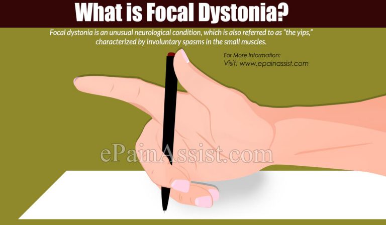 Focal Dystonia: Causes, Symptoms, Treatment, Risk Factors