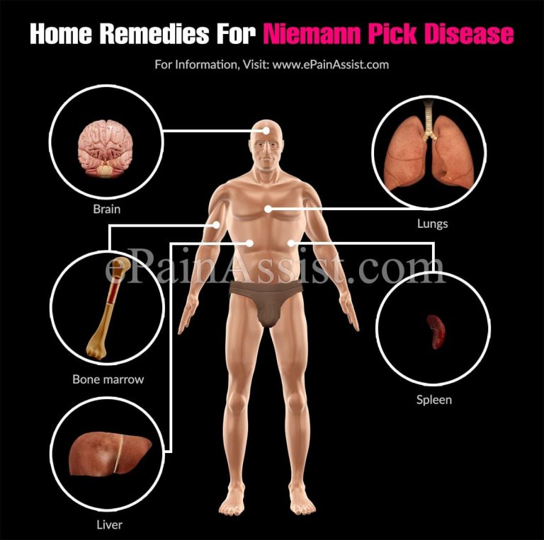 Home Remedies For Niemann Pick Disease