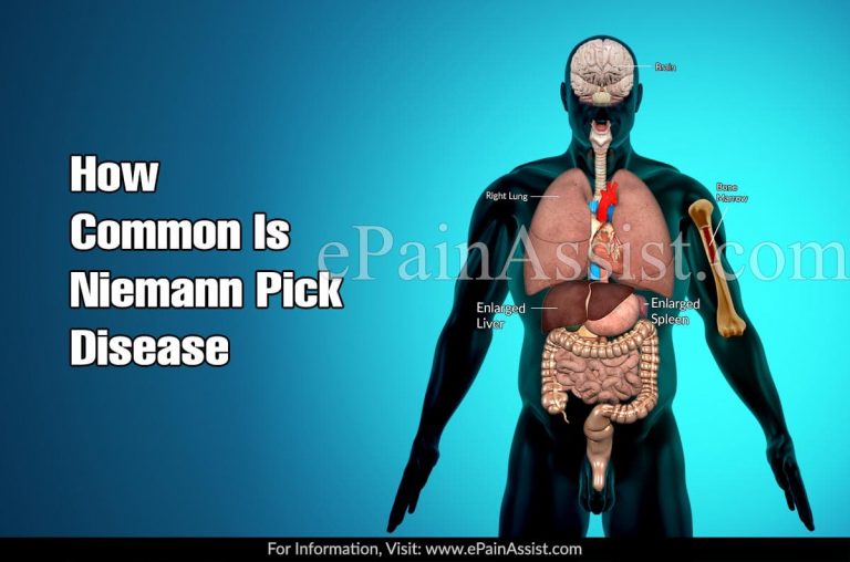 How Common Is Niemann Pick Disease Or Is It A Rare Disease?