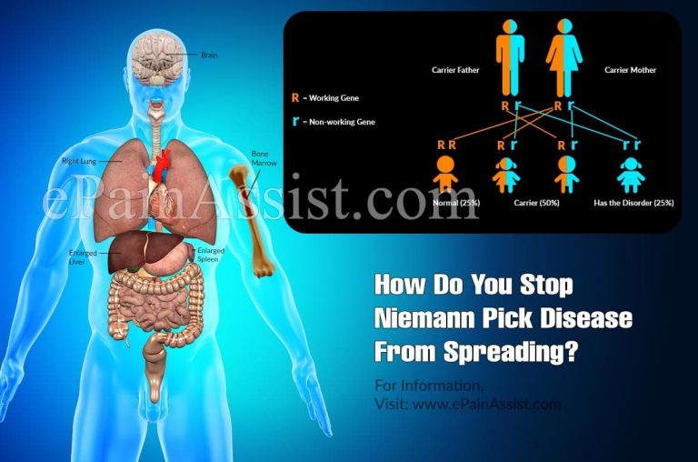 How Do You Stop Niemann Pick Disease From Spreading?