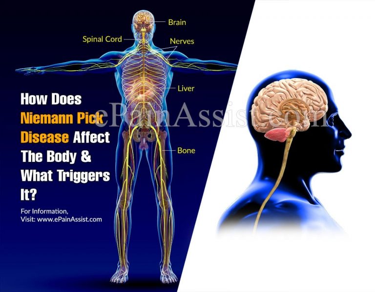 How Does Niemann Pick Disease Affect The Body & What Triggers It?