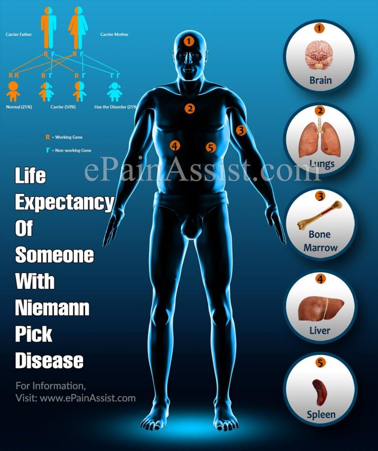 Life Expectancy Of Someone With Niemann Pick Disease