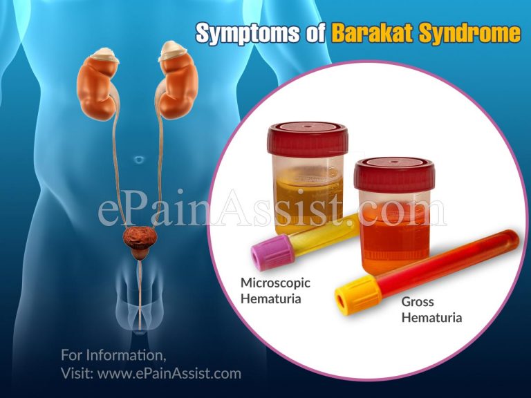 What is Barakat Syndrome & How is it Treated?|Causes, Symptoms, Complications of Barakat Syndrome