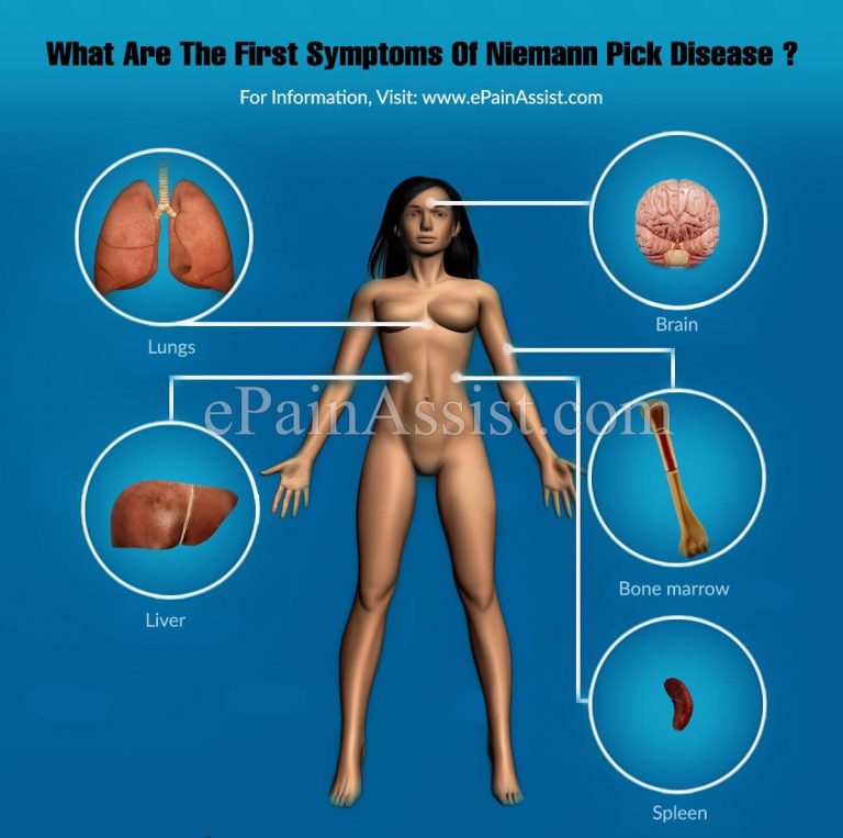 What Are The First Symptoms Of Niemann Pick Disease & How Do You Test For It?