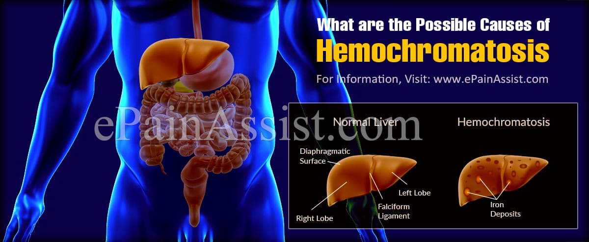 What are the Possible Causes of Hemochromatosis?