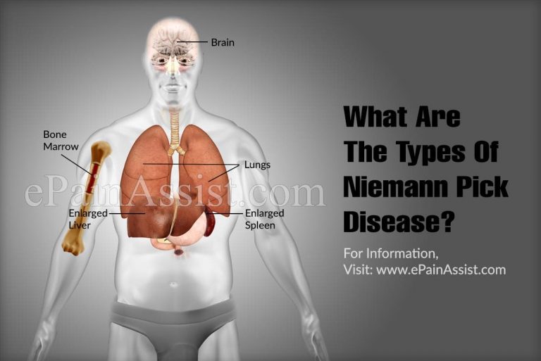 What Are The Types Of Niemann Pick Disease & How Is It Inherited?