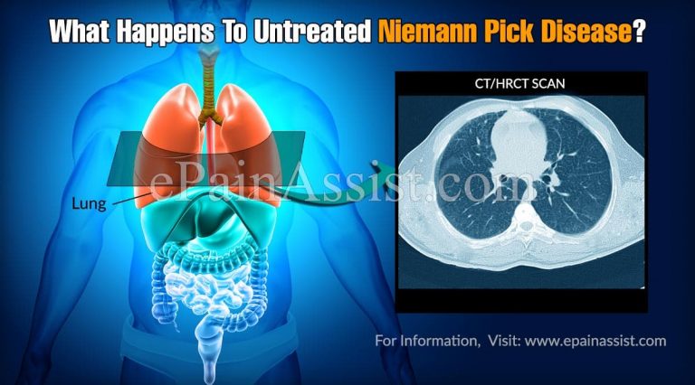 What Happens To Untreated Niemann Pick Disease & When To Go To Doctor?