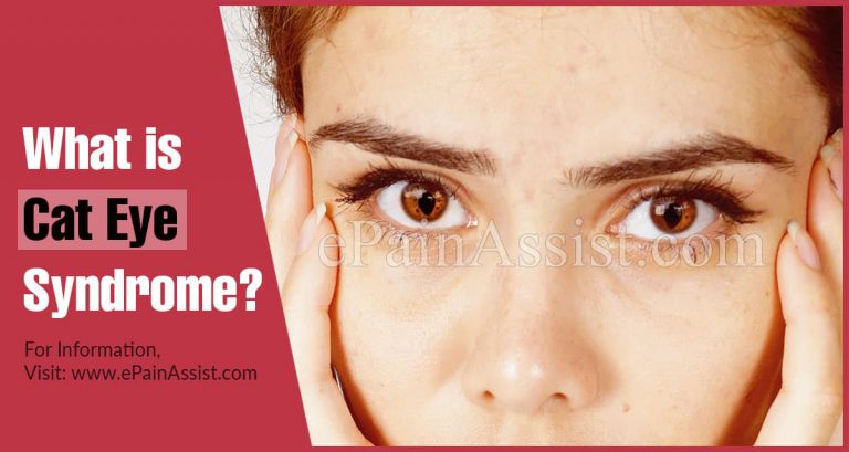 What is Cat Eye Syndrome: Causes, Symptoms, Treatment, Diagnosis