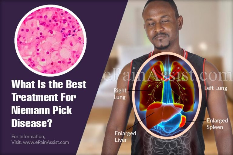 What Is the Best Treatment For Niemann Pick Disease?