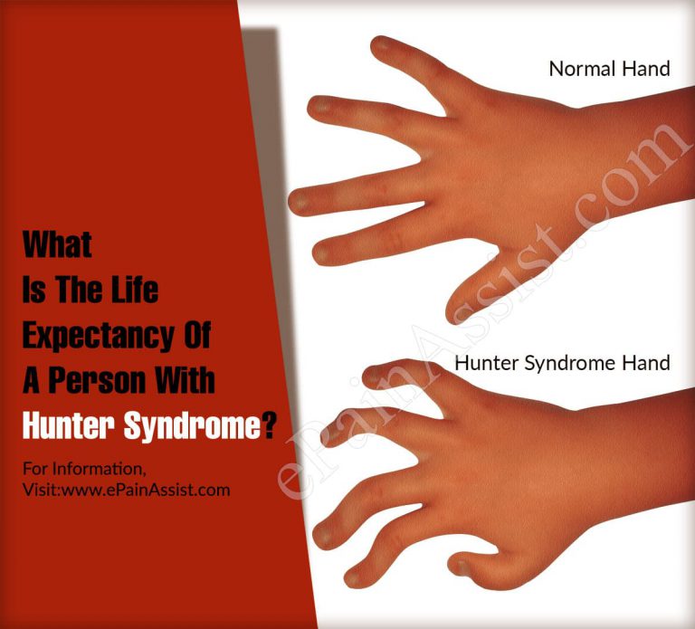 What Is The Life Expectancy Of A Person With Hunter Syndrome?
