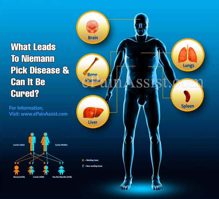 What Leads To Niemann Pick Disease & Can It Be Cured?