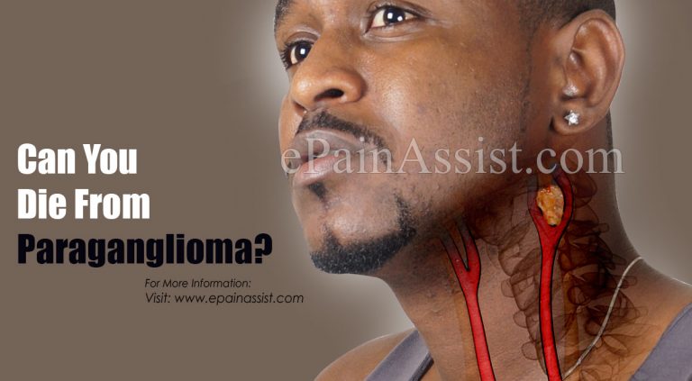 Can You Die From Paraganglioma & How Do You Stop It From Spreading?