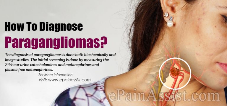 How To Diagnose Paragangliomas & What Is The Best Medicine For It?
