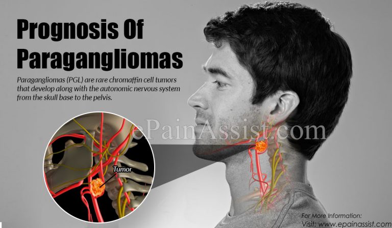 Prognosis For Paragangliomas & Home Remedies For It?
