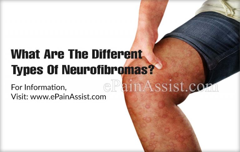 What Are The Different Types Of Neurofibromas?