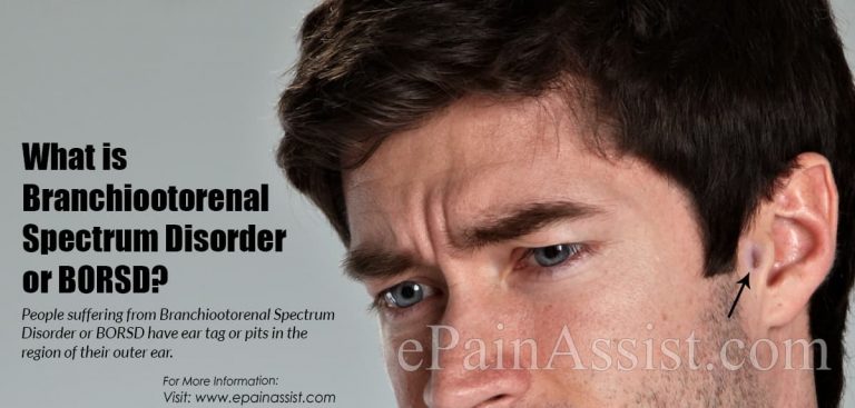 What is Branchiootorenal Spectrum Disorder & How is it Treated?| Causes, Symptoms, Treatment, Epidemiology, Diagnosis of BORSD