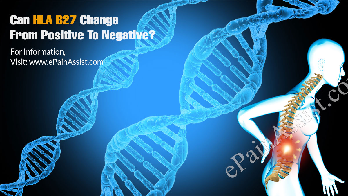 Can HLA B27 Change From Positive To Negative?