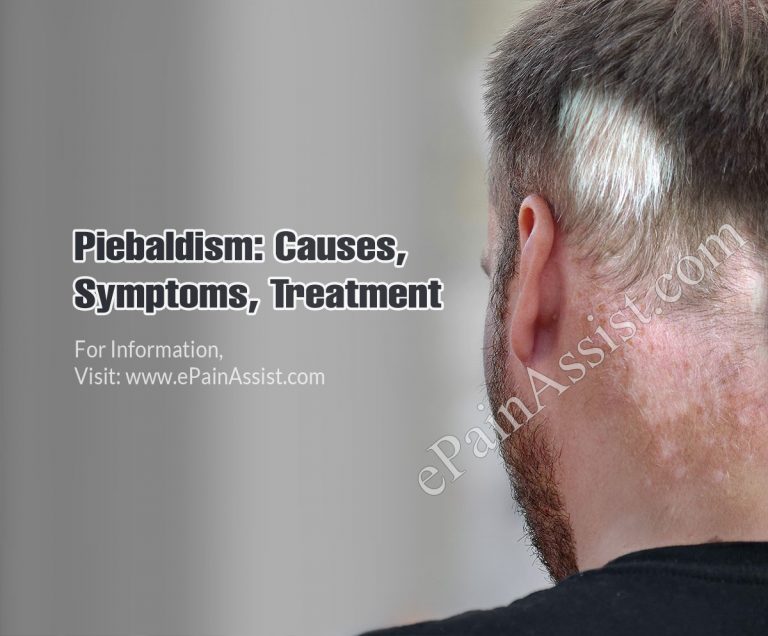 Piebaldism: Causes, Symptoms, Treatment