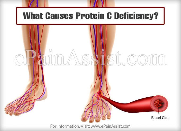What Causes Protein C Deficiency And What To Do About It?