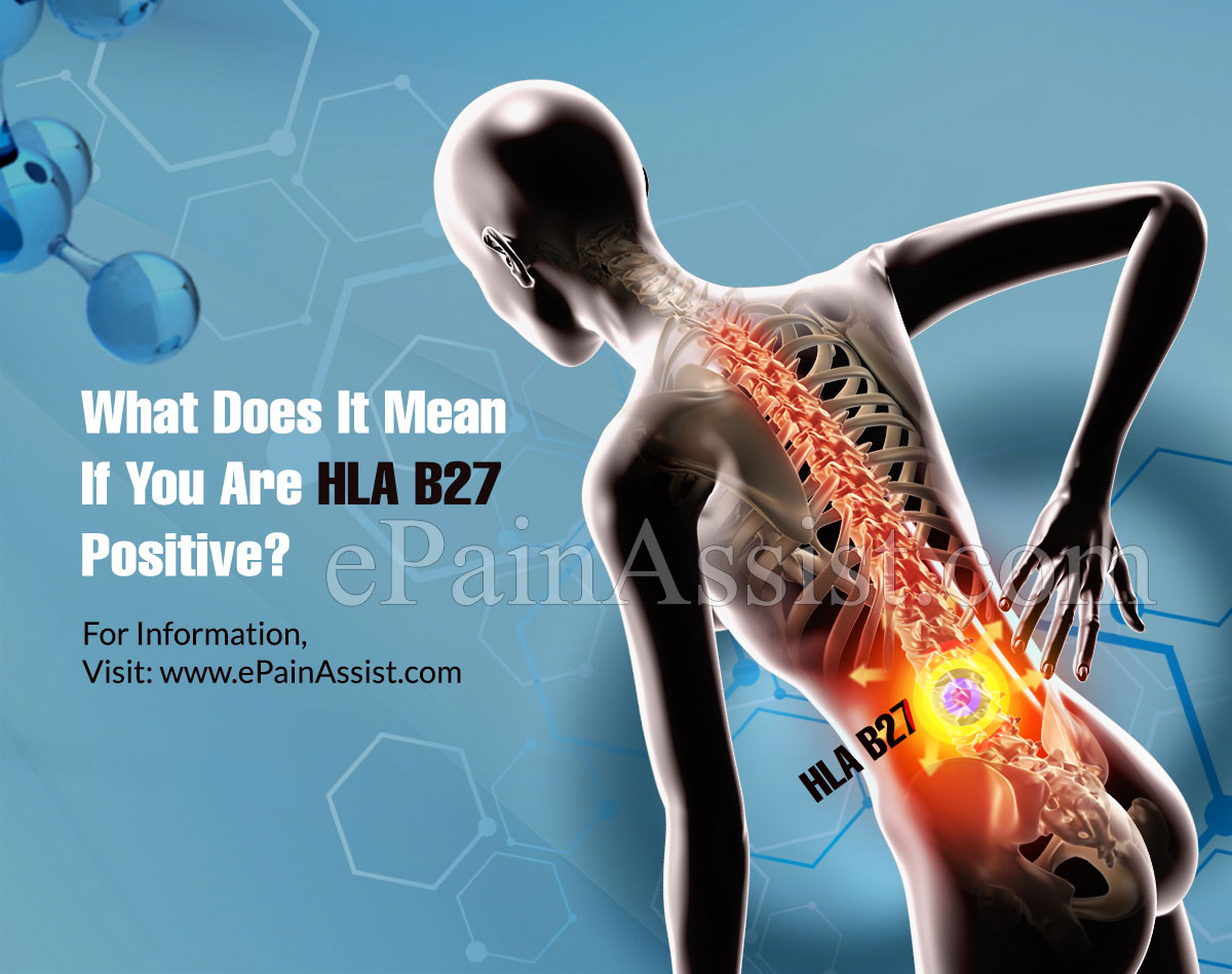 What Does It Mean If You Are HLA B27 Positive?