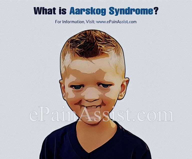 What is Aarskog Syndrome & How is it Treated?|Causes, Symptoms and Diagnosis of Aarskog Syndrome