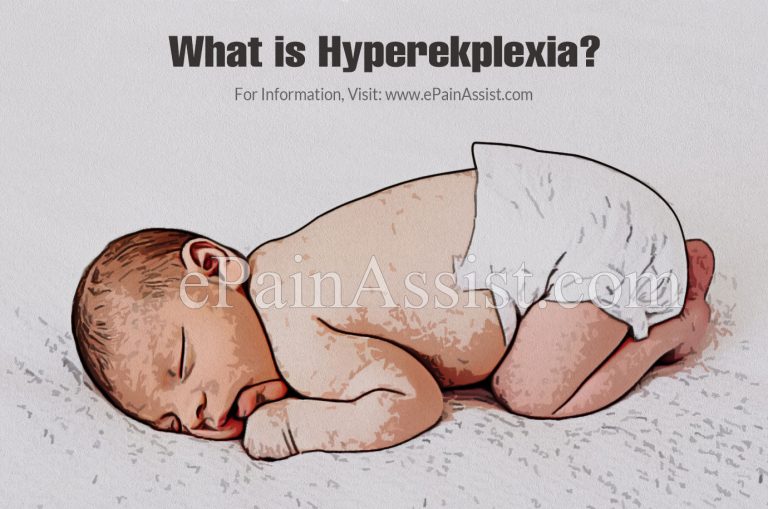 What is Hyperekplexia & How is it Treated? | Causes and Symptoms of Hyperekplexia