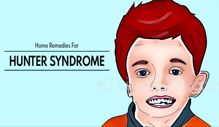 Home Remedies For Hunter Syndrome