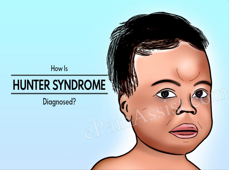 How Is Hunter Syndrome Diagnosed?