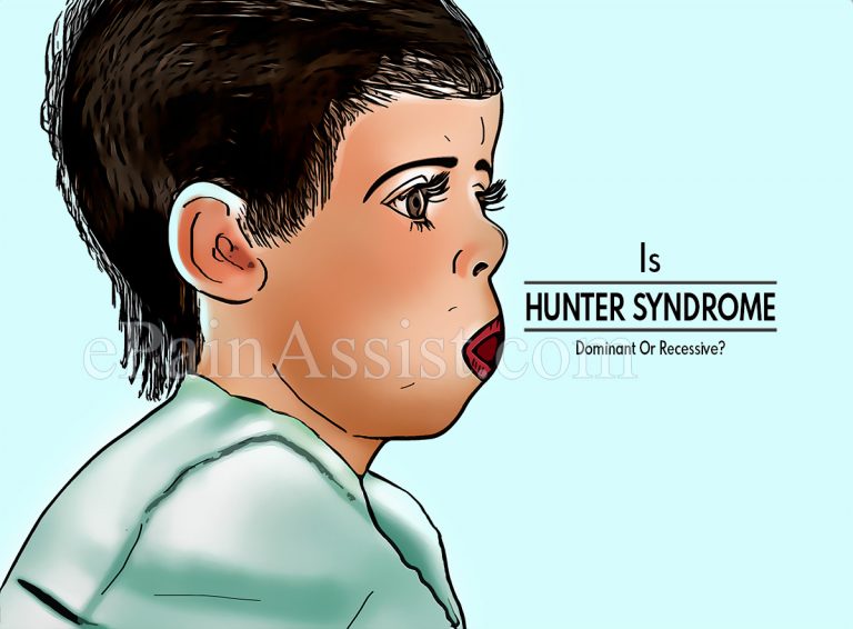 Is Hunter Syndrome Dominant Or Recessive?