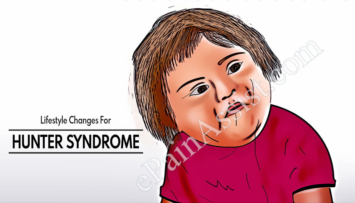 Lifestyle Changes For Hunter Syndrome