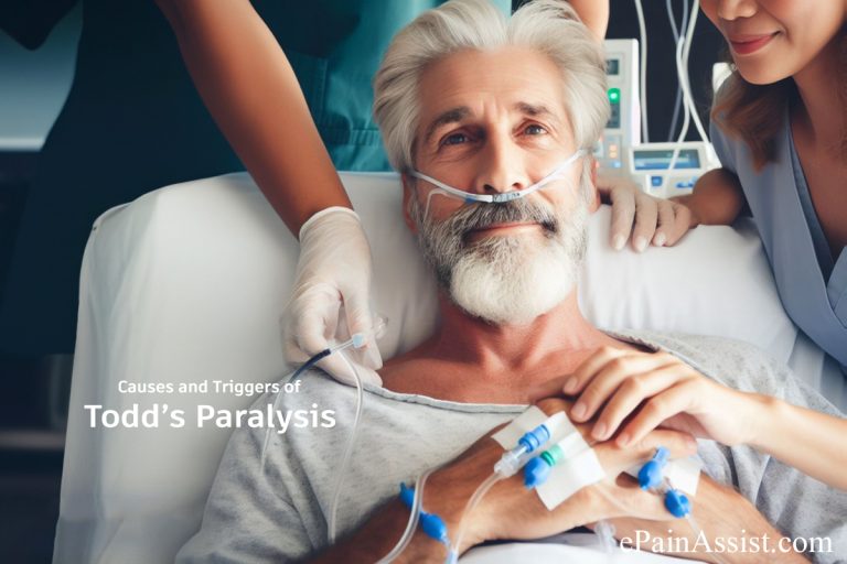 Decoding Todd’s Paralysis : Causes, Symptoms, and Recovery Time