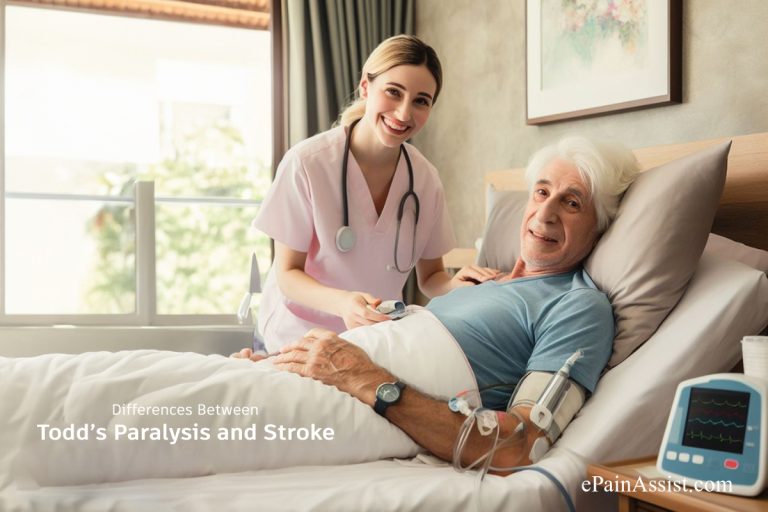 Differential Diagnosis : Todd’s Paralysis vs. Stroke – Key Differences Explained