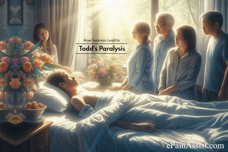 How Seizures Lead to Todd’s Paralysis and Its Role as an Epileptic Indicator : Unraveling the Link