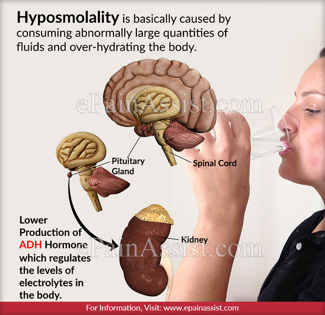 Hyposmolality