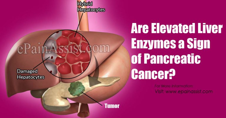Are Elevated Liver Enzymes a Sign of Pancreatic Cancer?
