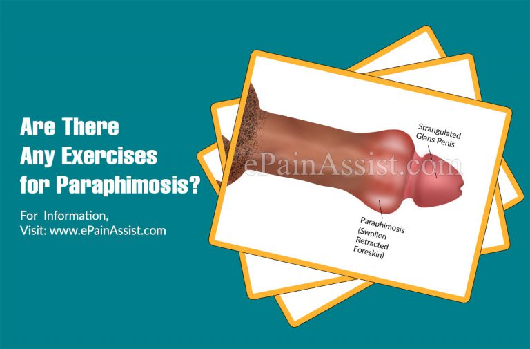 Are There Any Exercises for Paraphimosis?