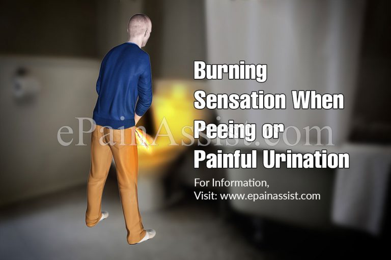 Burning Sensation When Peeing or Painful Urination: Causes, Treatment, Home Remedies