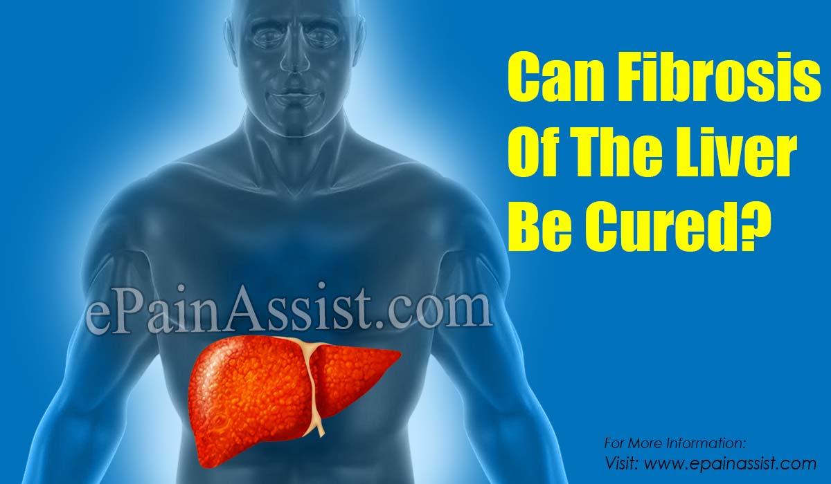 Can Fibrosis Of The Liver Be Cured?