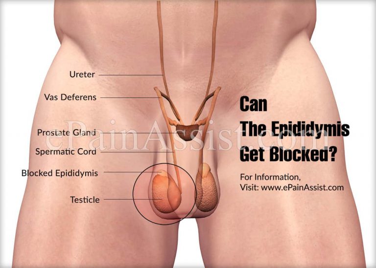 Can The Epididymis Get Blocked?