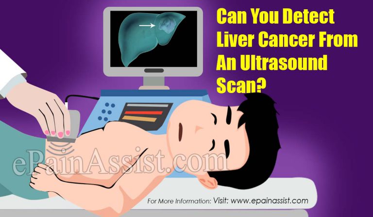 Can You Detect Liver Cancer From An Ultrasound Scan?