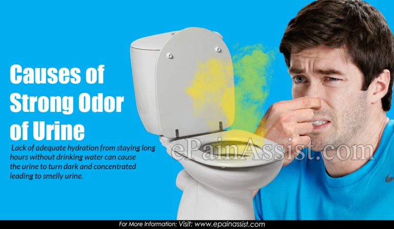 Causes of Strong Odor of Urine