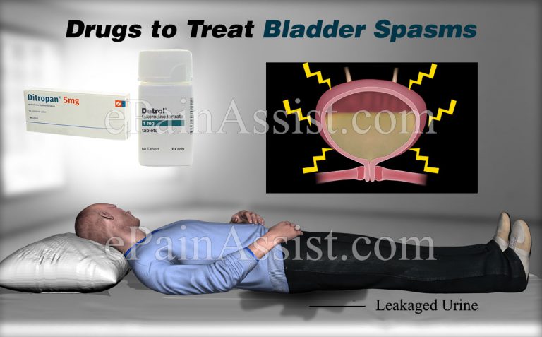 Drugs to Treat Bladder Spasms