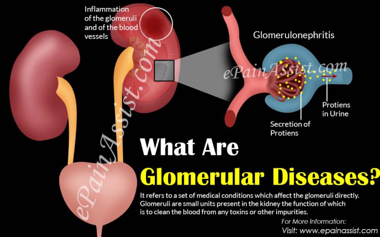 Glomerular Diseases: How Does It Affect the Kidneys and What is its Treatment?