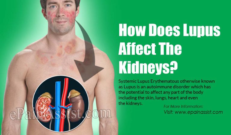 How Does Lupus Affect The Kidneys?